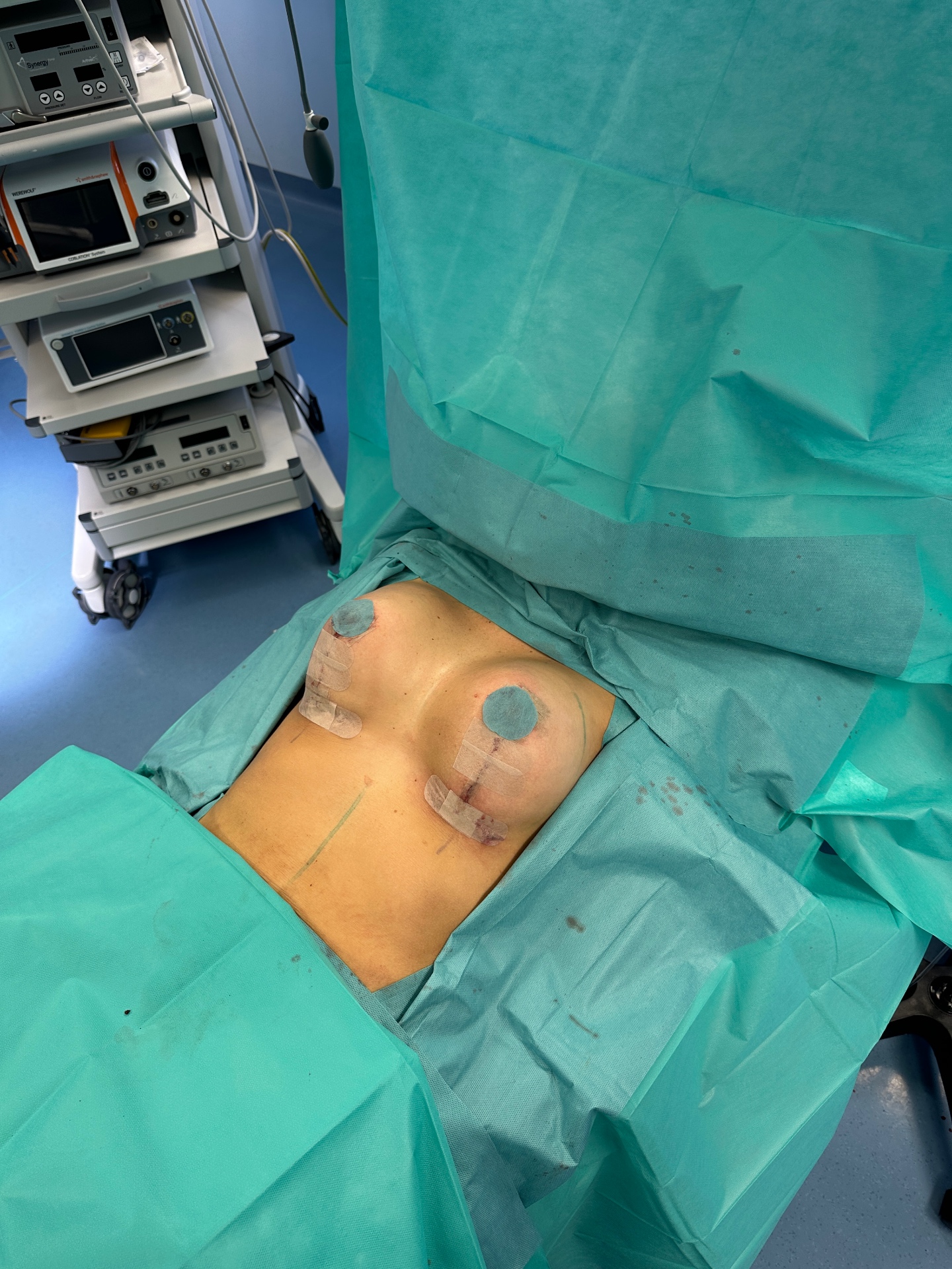Post-OP · symmetrische Kontur