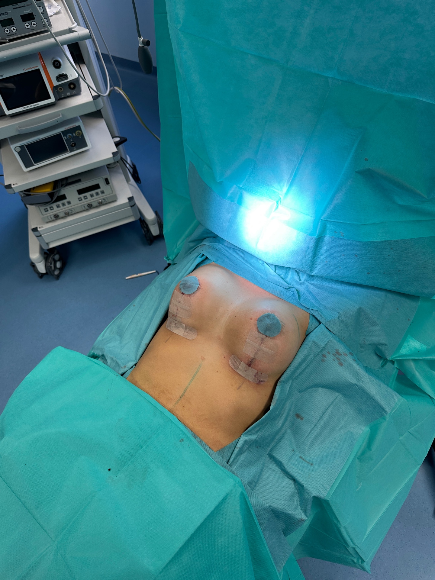 Post-OP · Tapes & Kontrolle